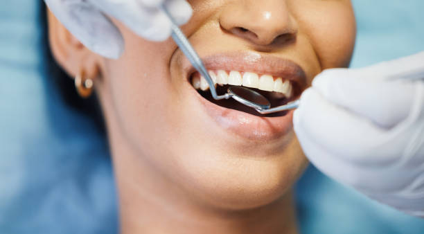 Best Dental Fillings (Composite and Amalgam)  in St Helen, MI